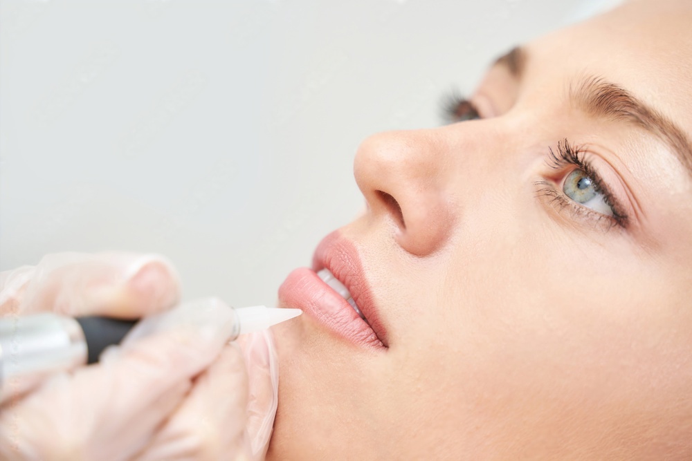 micro_pigmentation